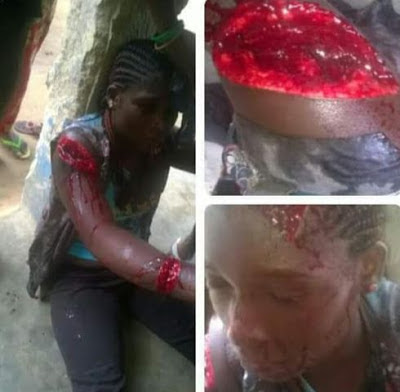 Woman allegedly attacks her husband's side chick with machete in Cross River(Graphic photos)