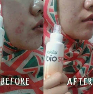 testimoni-bio-spray-msi