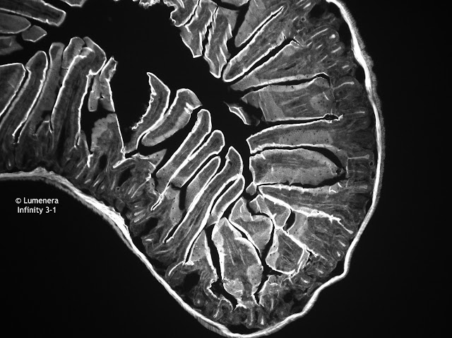 Mouse intestine under the microscope captured with Lumenera Infinity 3-1 CCD camera.