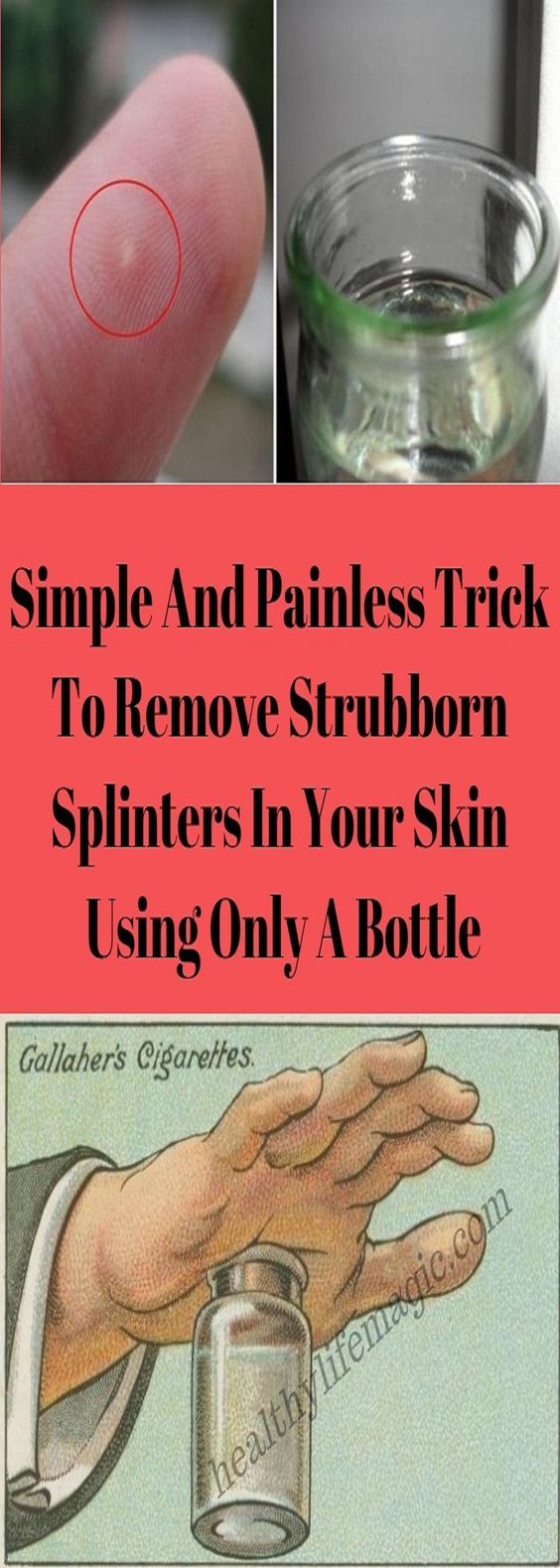 Simple And Painless Trick To Remove Strubborn Splinters In Your Skin ...