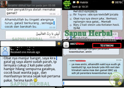 Cara Menyembuhkan Kutu Air Bernanah Yang Membandel Secara Alami Cara Menyembuhkan Kutu Air Bernanah Yang Membandel Secara Alami