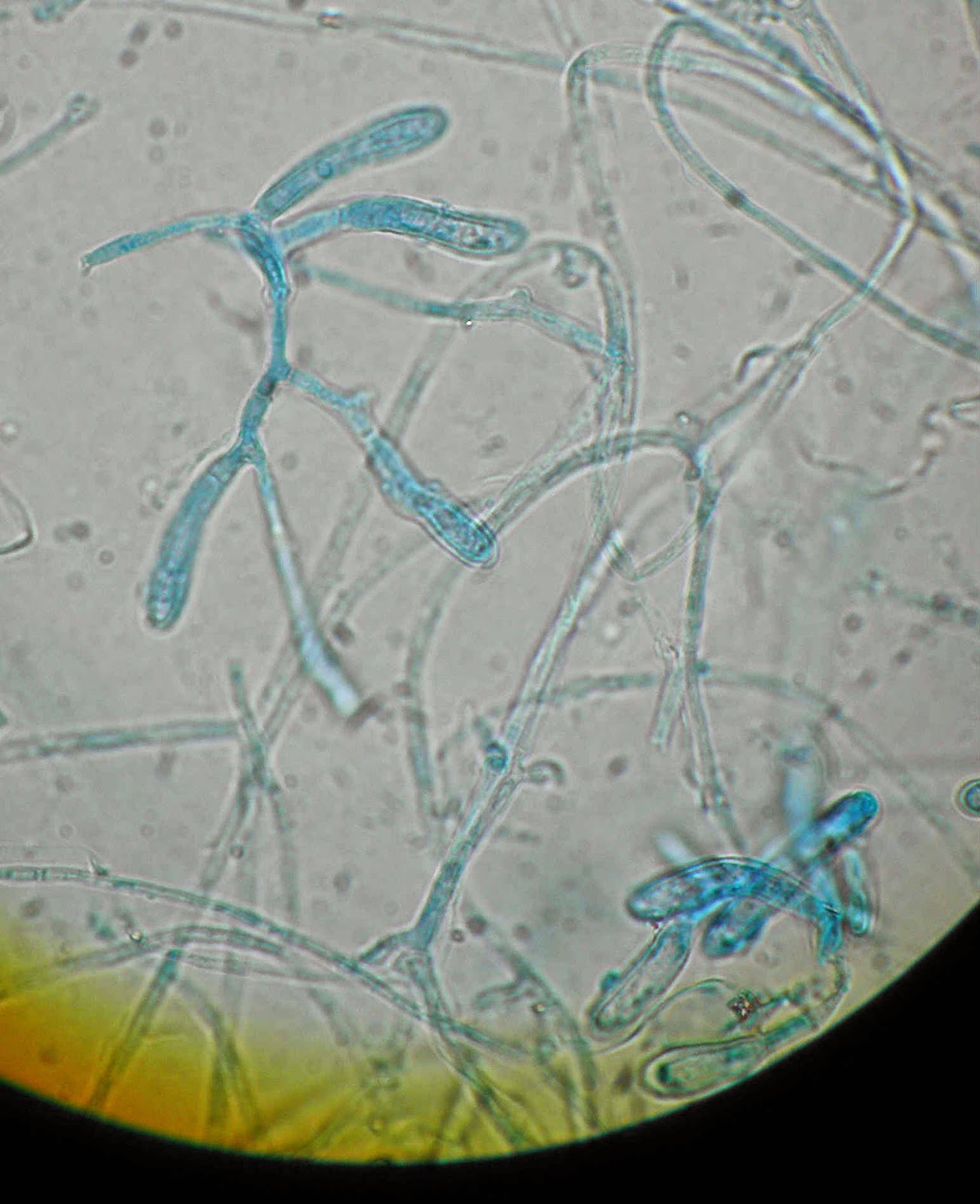 Epidermophyton floccosum