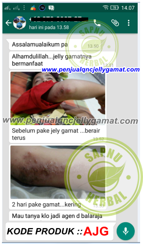 Obat Tradisional Untuk Luka Menganga Obat Tradisional Untuk Luka Menganga