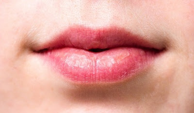 Dry lips Causes, Cracked, Treatment