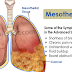 LAW FIRMS HANDLING MESOTHELIOMA RELATED CASES