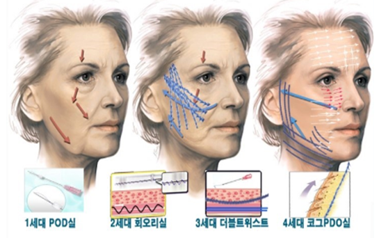 Non-surgical skin tightening and lifting, non-surgical, non surgical, skin, tightening, lifting, skin tightening, skin lifting