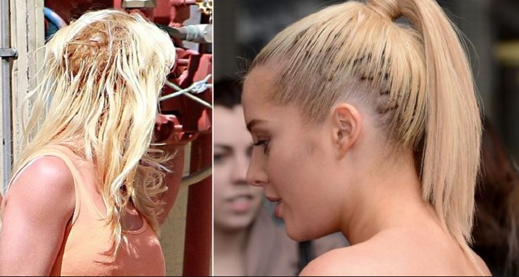 Allergic To Hair Extensions Off 70 Buy