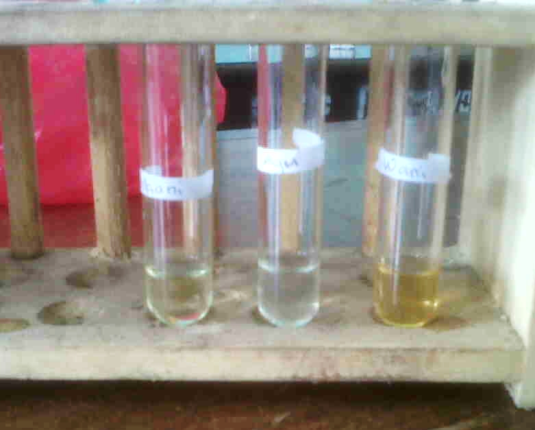 Kelompok 2 Biologi Tugas Sistem Ekskresi Kelompok 2 Biologi Tugas Sistem Ekskresi