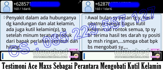 Penyebab Kutil di Anus dan Cara Mengobatinya Penyebab Kutil di Anus dan Cara Mengobatinya