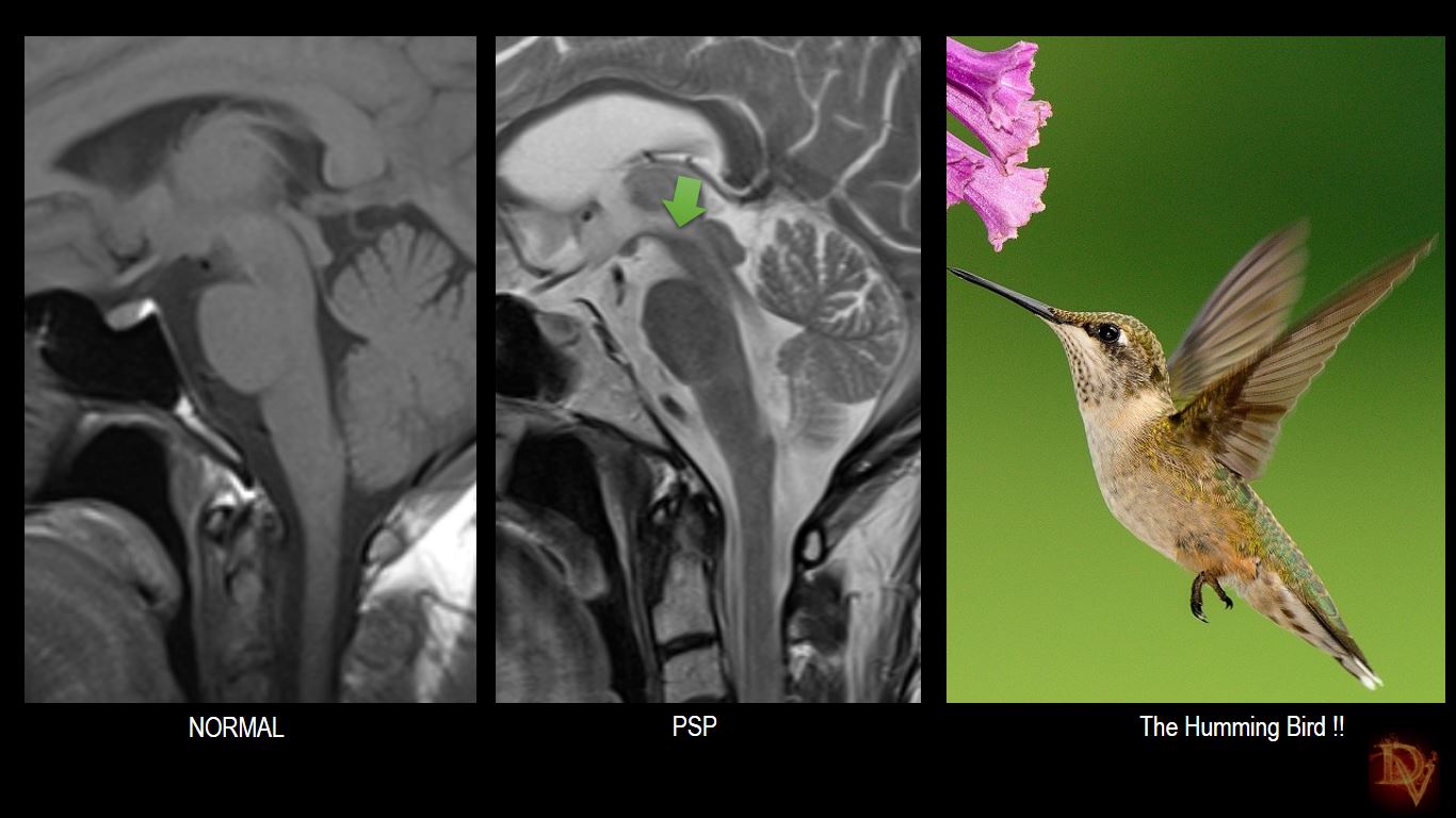 Ultimate Radiology 'Hummingbird and Morning Glory' of Radiology