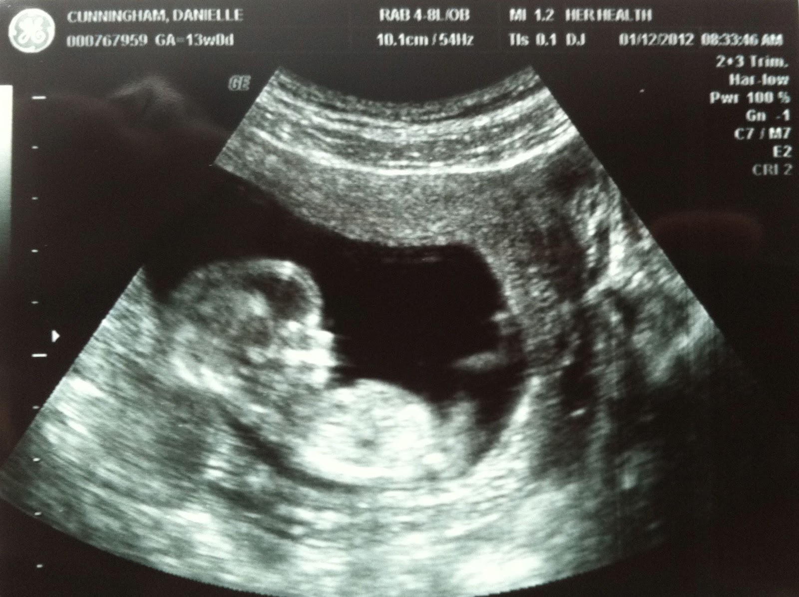 travis-danielle-13-week-ultrasound