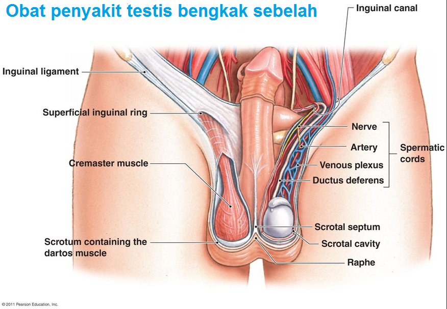 Obat penyakit testis bengkak sebelah