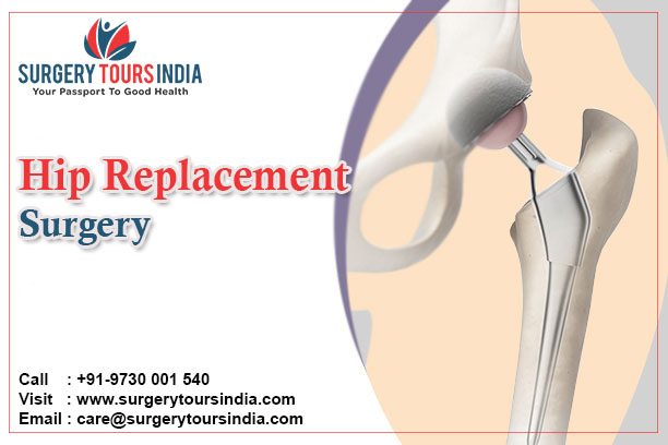 Hip Replacement Surgery India