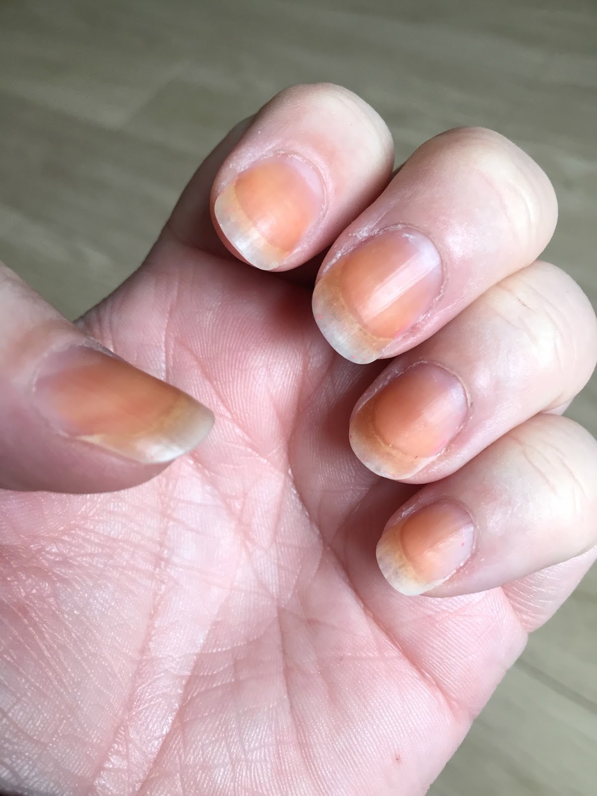 Ruth Langsford - HELP! Tumeric isn't coming off despite much scrubbing with  my fav stain remover! Any suggestions @hemsleyhemsley Anyone?! #yellownails  | Facebook