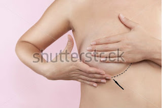 risk with aesthetic breast surgery,recovery time after aesthetic breast surgery,what is aesthetic breast surgery