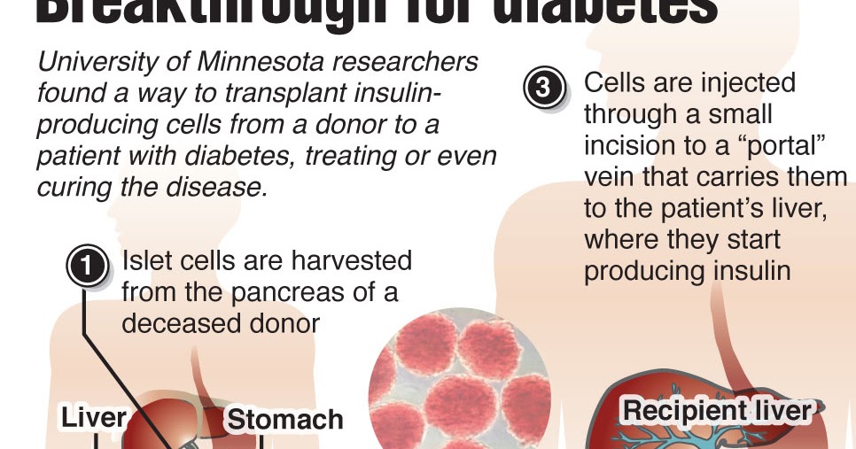 type 1 diabetes cure health articles