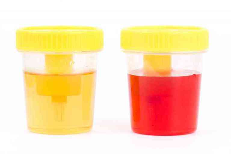 What the Color of Your Urine Says About Your Health NEWSOLOGYS