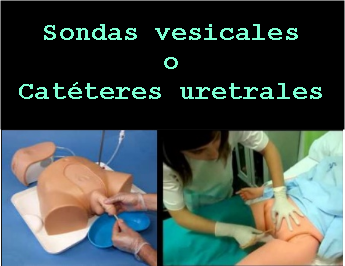 drenar la prostata