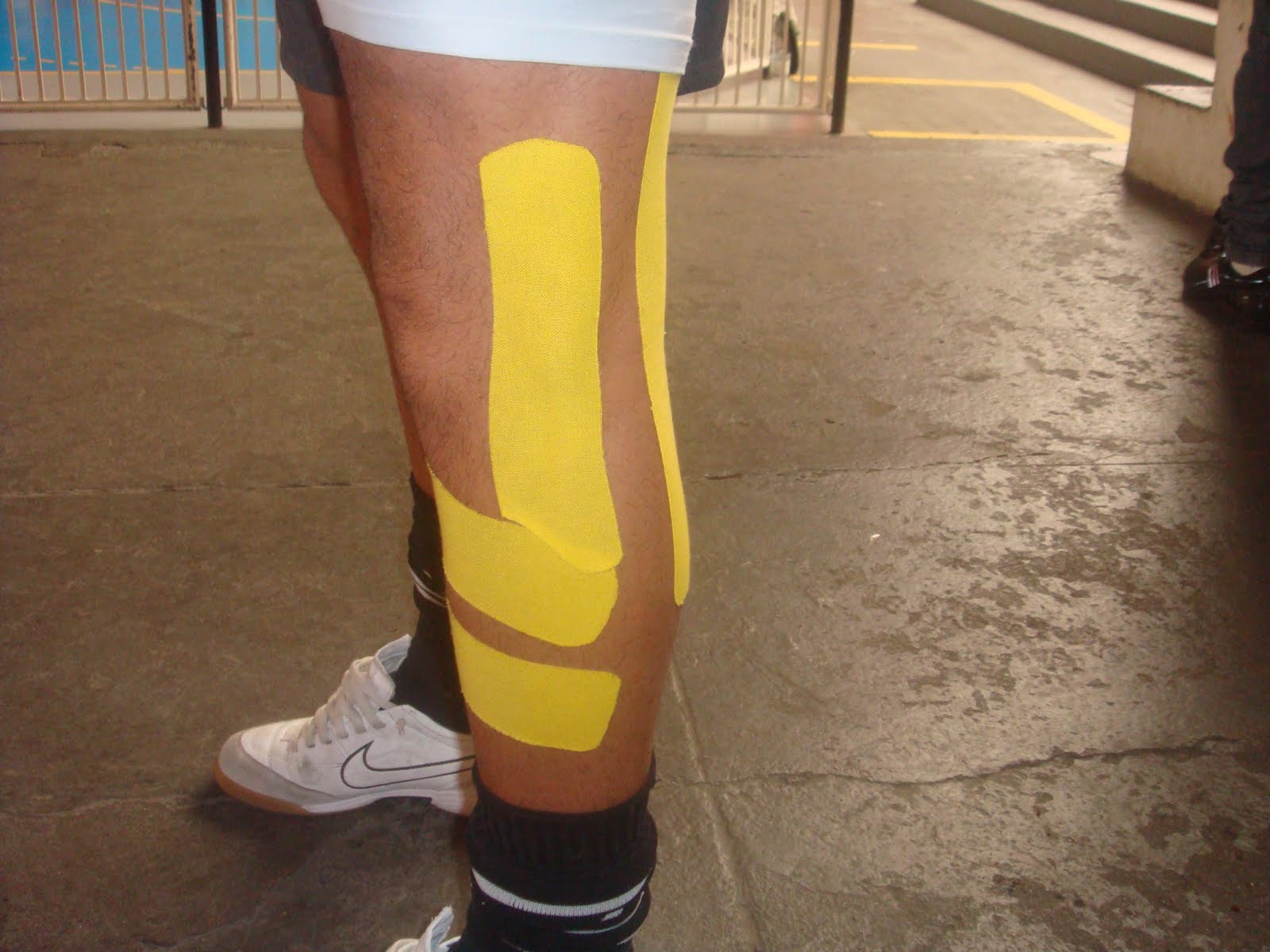 FISIOTERAPIA DESPORTIVA Conheça a bandagem terapêutica, método japonês