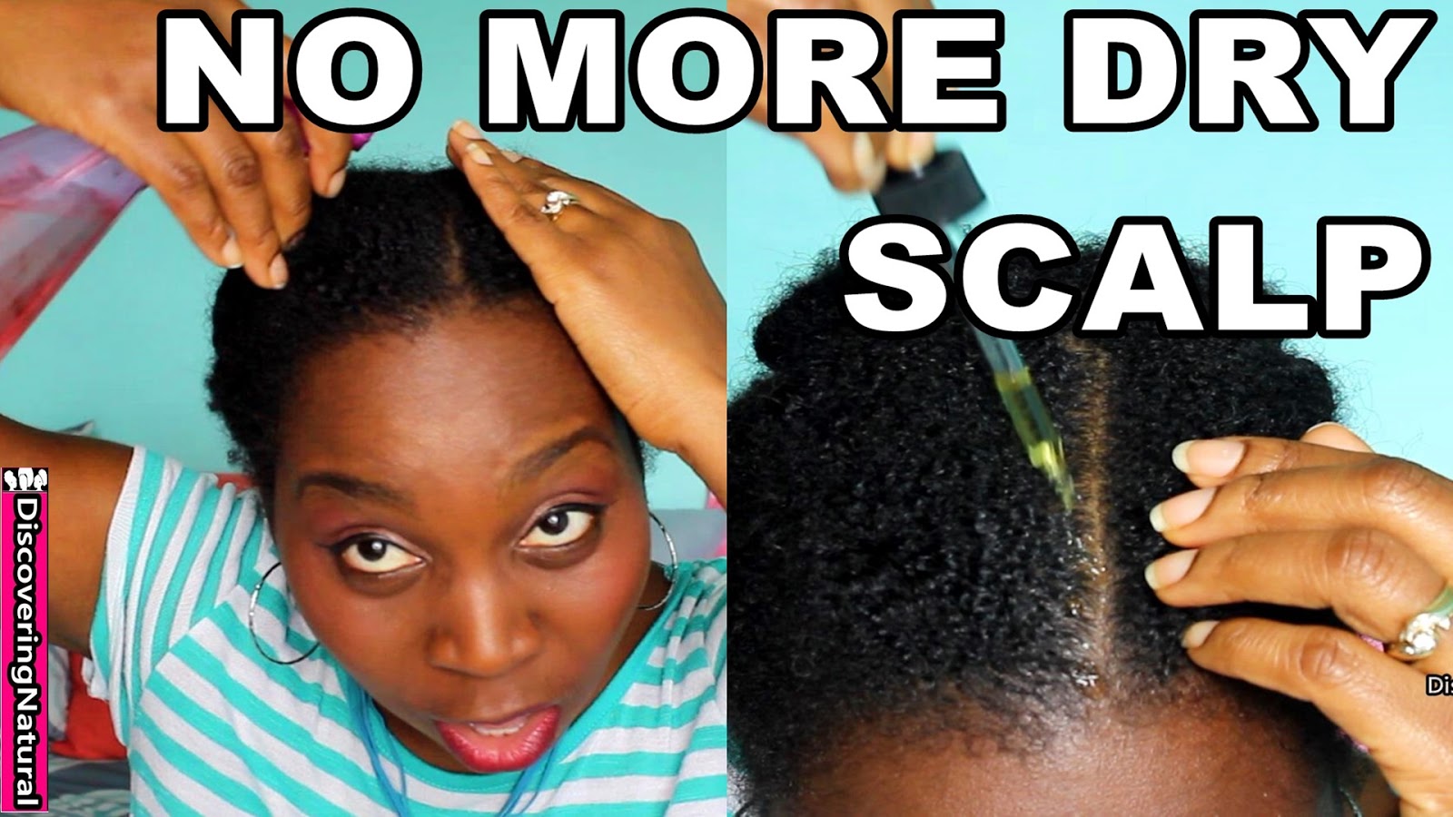 How to Moisturize Dry Scalp