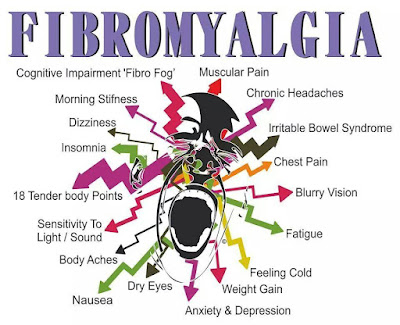 Lupus Brain Fog Diet Plan