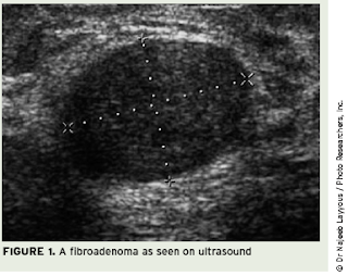 Ultrasoundand not on my belly :  BabyCenter