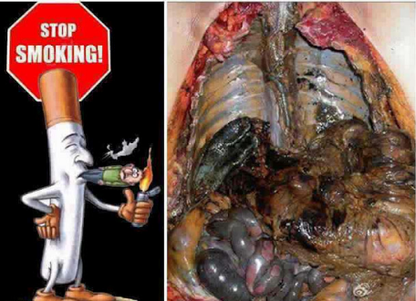 Bahaya Merokok bagi Kesehatan