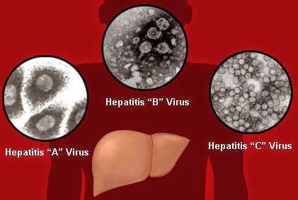 Penampakan virus hepatitis A, B dan C yang menyebabkan pembengkakan hati