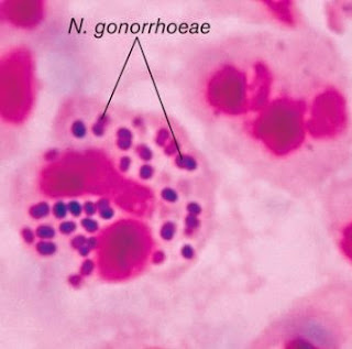 Pengelompokan bakteri berdasarkan bentuk Monococcus contohnya yaitu Neisseria gonorrhoeae