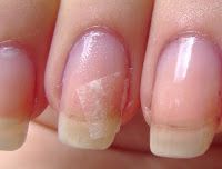 How to repair a broken nail ~ lifestyle tips for all How to repair a broken nail ~ Lifestyle Tips for all