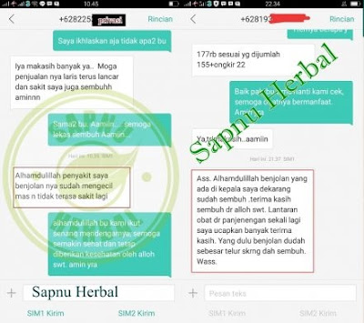 Cara Menghilangkan Benjolan Lunak Di Pipi Dekat Telinga Secara Alami Cara Menghilangkan Benjolan Lunak Di Pipi Dekat Telinga Secara Alami
