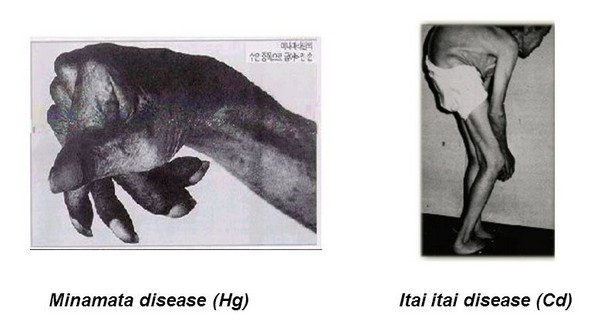 Chronic Kidney Diseases CadmiumInduced Chronic Kidney