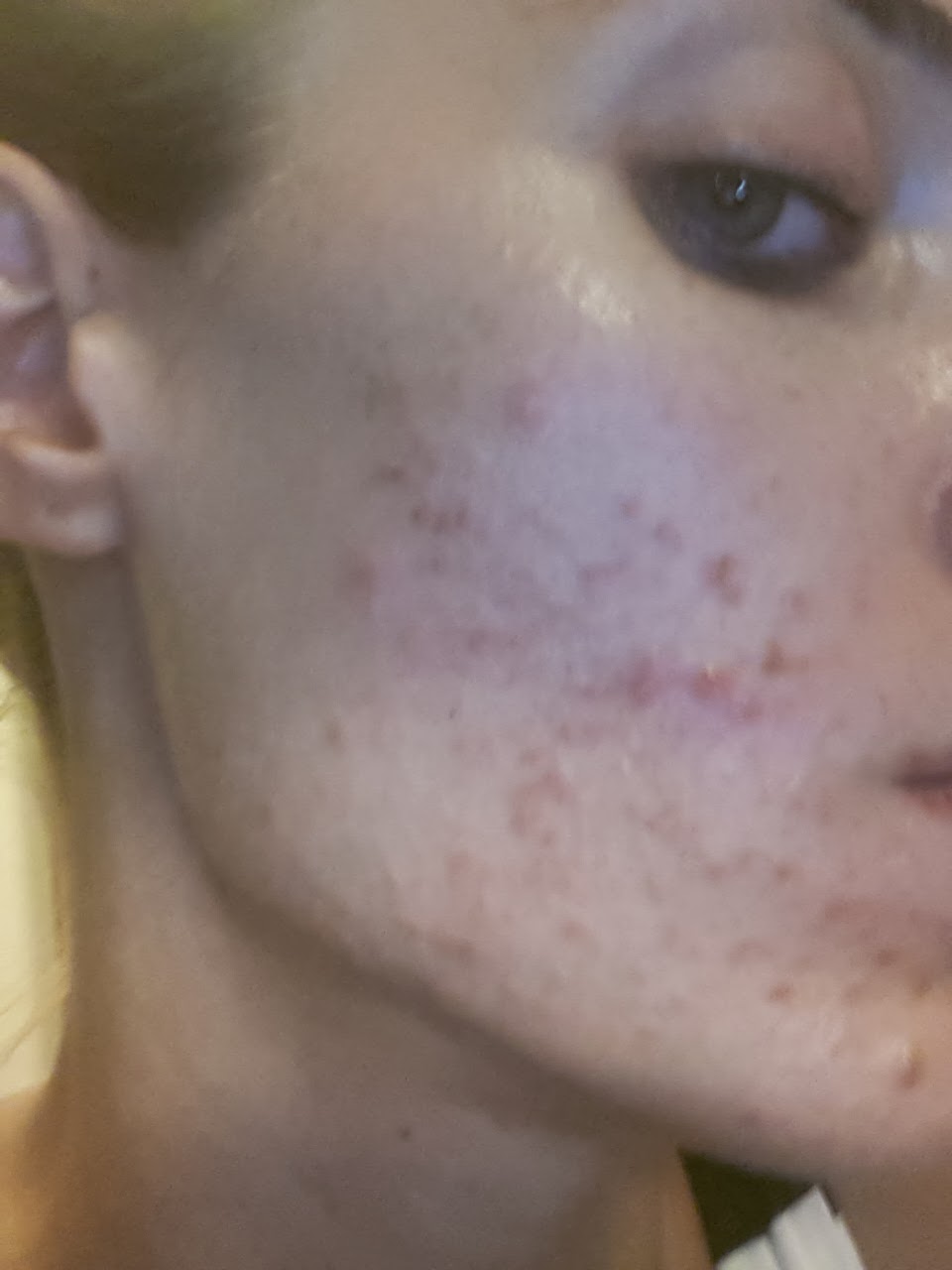 MAKEUP IN BODRUM . . . . . . . . . MAKEUP FOR LOVE . . . . .: Tedavi