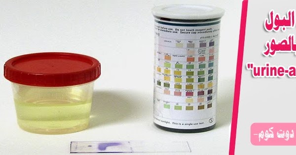 urine analysis تحليل pdf