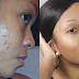 How To Remove Black Skin Care Products For Dark Spots Naturally?