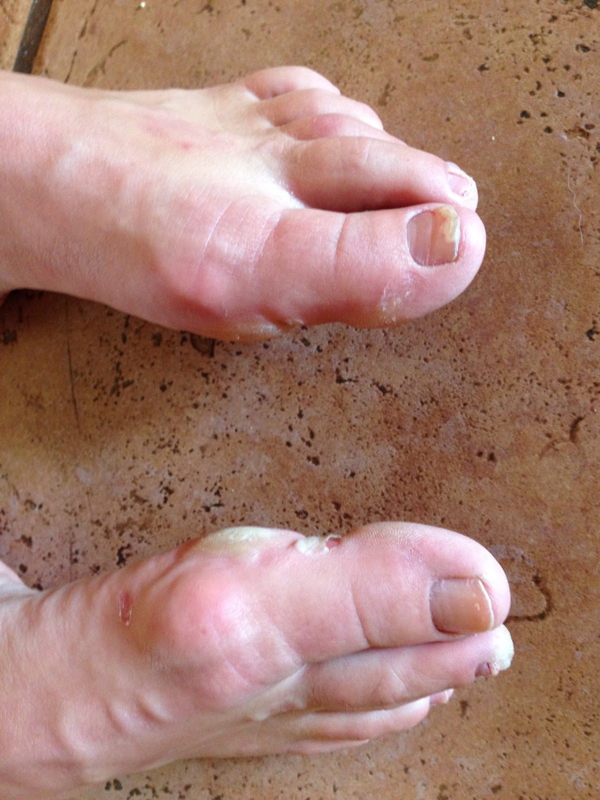 Running Shoes and Bugaboo's Gnarly toes!