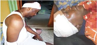 APC Lagos Primaries: hoodlums kill one, others injure