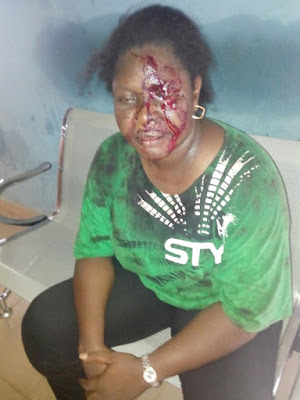 atack Photos: Man attacks woman for laughing at him while he was on a motorcycle in Benue