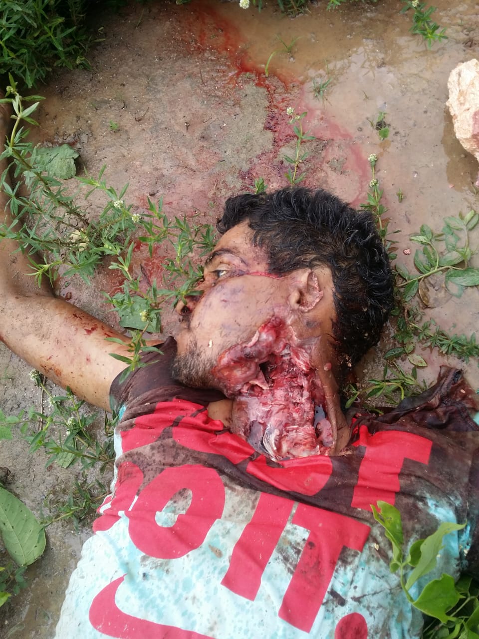 Rapaz morto a "facãozada" imagens fortes  Zap Marabá