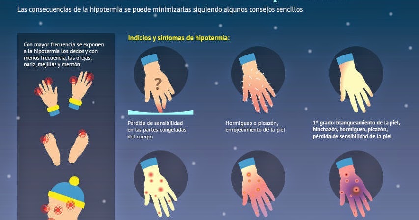 Первая стадия обморожения руки. При обморожении 1 степени. Помощь при обморожении конечностей 1 степени. При обморожении 1 степени необходимо. Симптомы характерные для 1 степени обморожения.