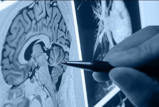 Tumori: nuova terapia contro il cancro con l'immunoterapia
