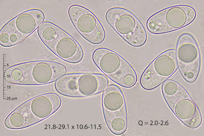 Octospora musci-muralis
