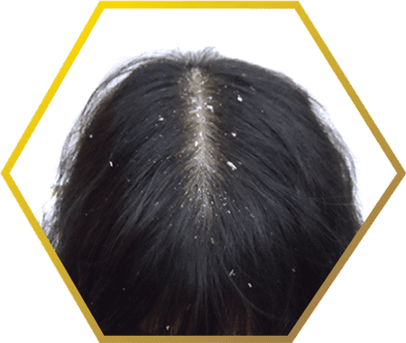 How to Apply Curd on Hair: 12 Steps (with Pictures) - wikiHow