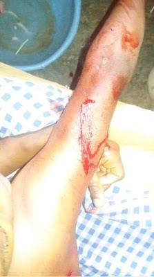 Woman Batters Housegirl Over Allegedly Stealing Her Baby's Milk