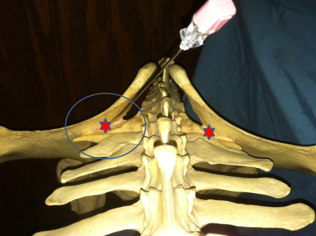 Michael Porter, Equine Veterinarian Sacro Iliac Injection!