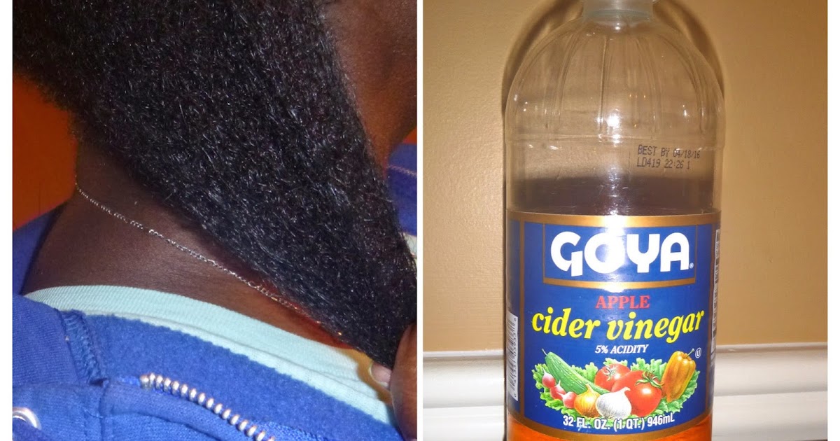 Apple Cider Vinegar pH Balance and Seborrheic Dermatitis