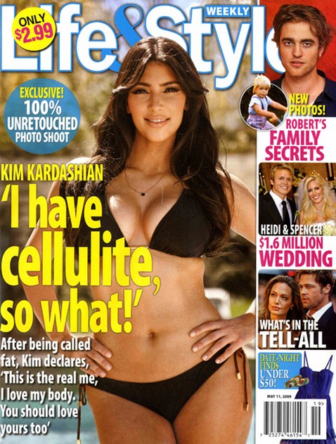 Cellulite Treatment Reviews Kim Kardashian Cellulite