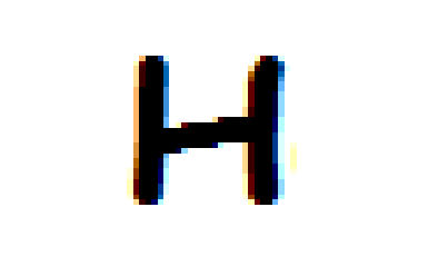 Healthydw - Alopecia, Baldness, Dandruff, Hair Falling, Hairstyle