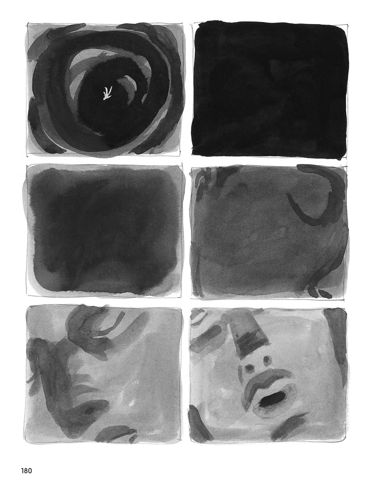 Read online Stitches: A Memoir comic -  Issue # TPB (Part 2) - 80