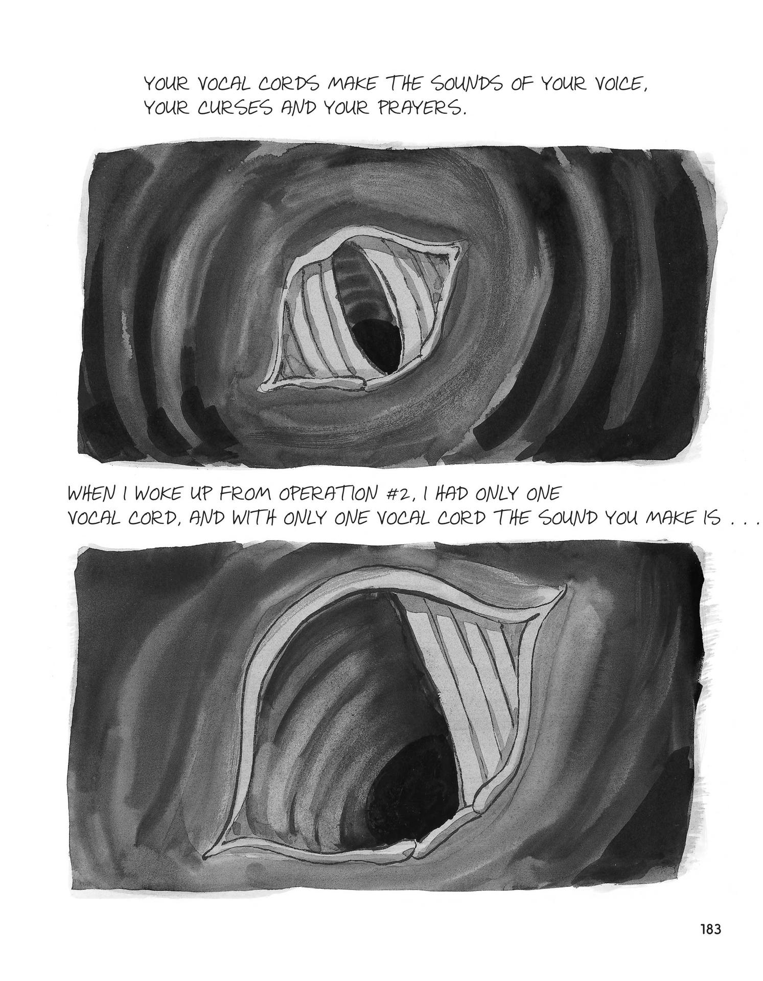 Read online Stitches: A Memoir comic -  Issue # TPB (Part 2) - 83